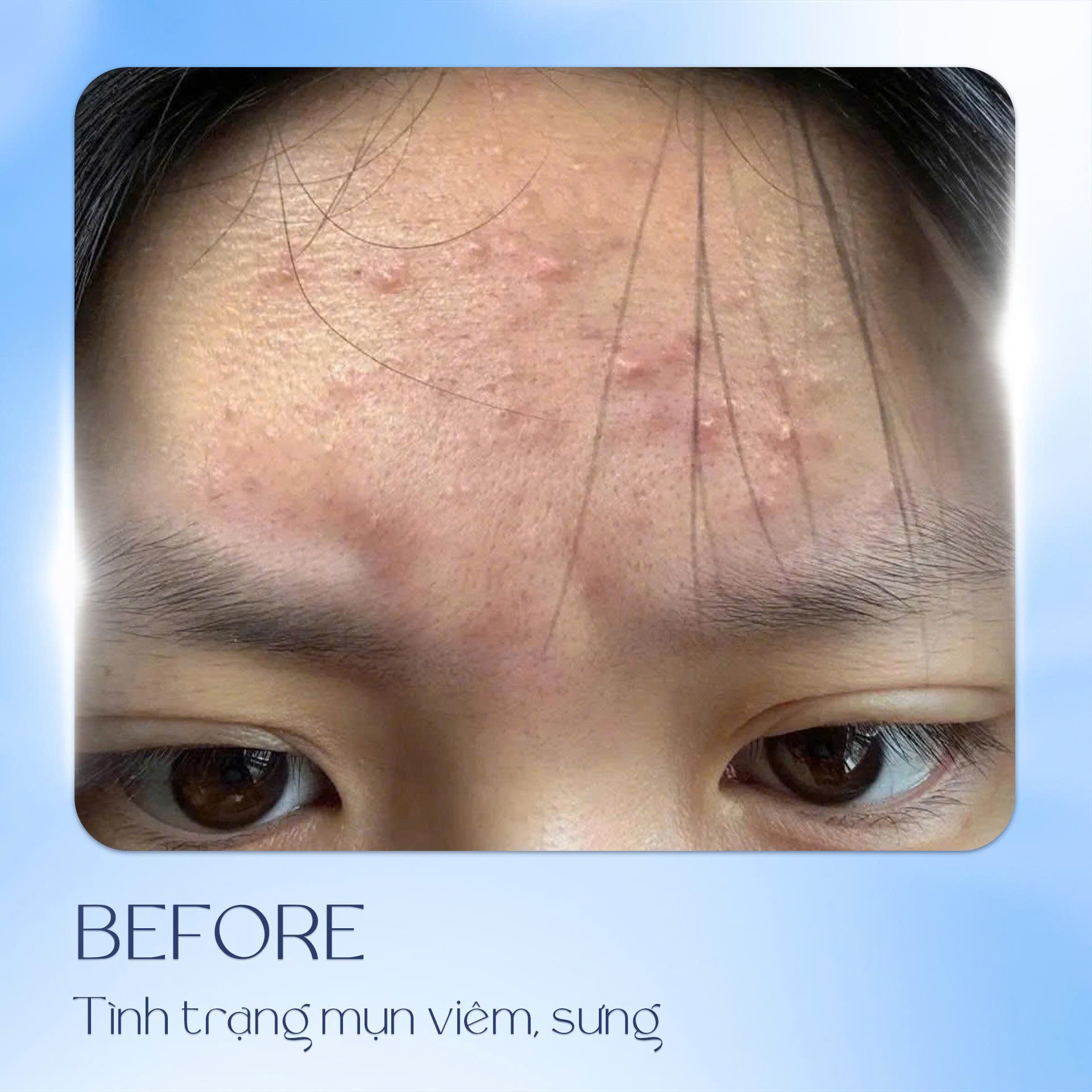 Khách hàng phục hồi da