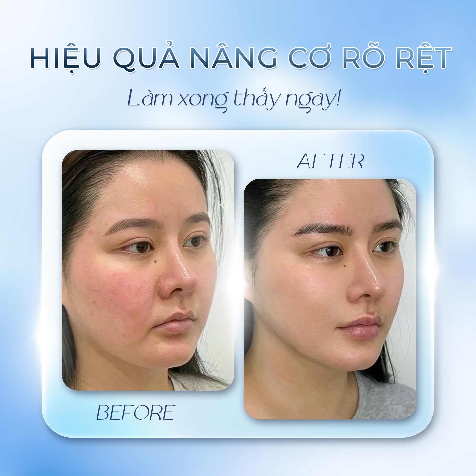 Khách hàng căng chỉ